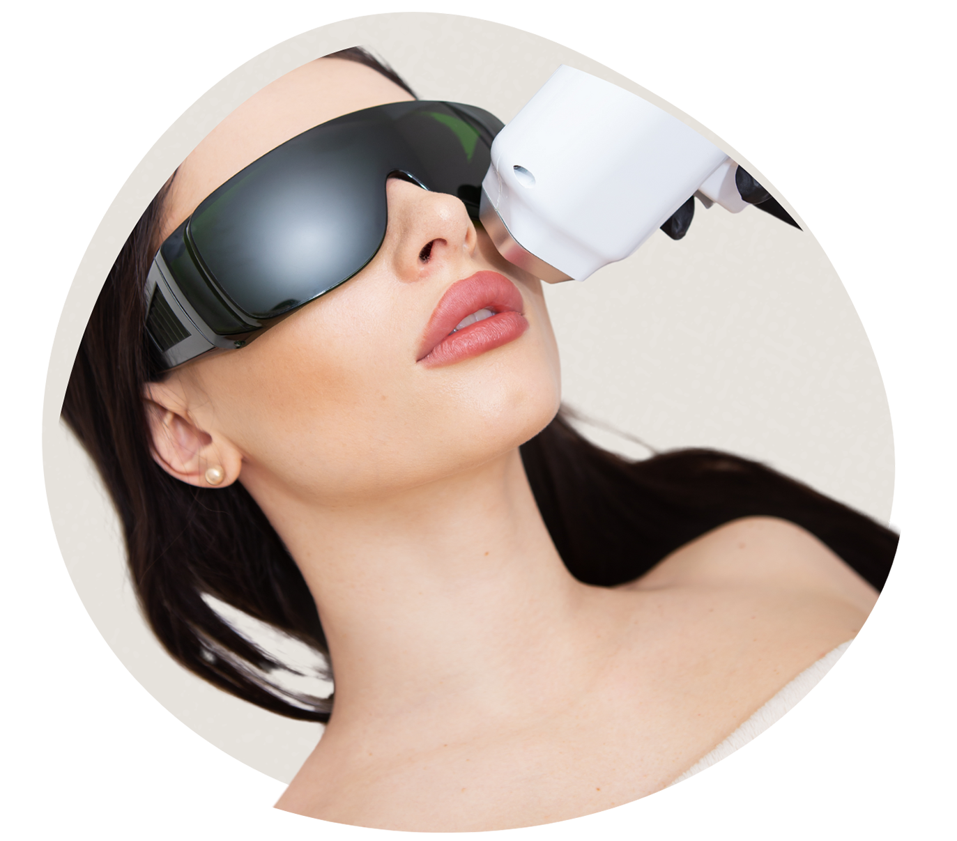 Luz Pulsada Intensa (IPL)